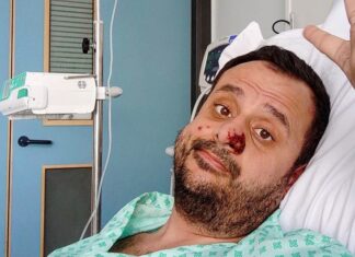 La OMS declara el fin de la emergencia por la viruela del mono